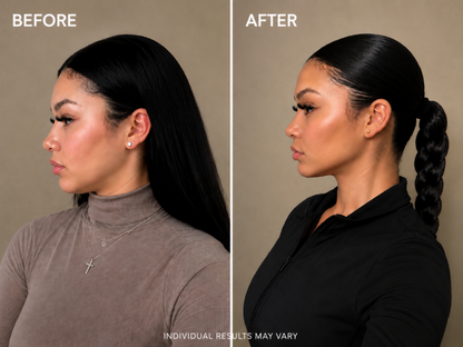 Glowviee™ Facial Sculpting Cups